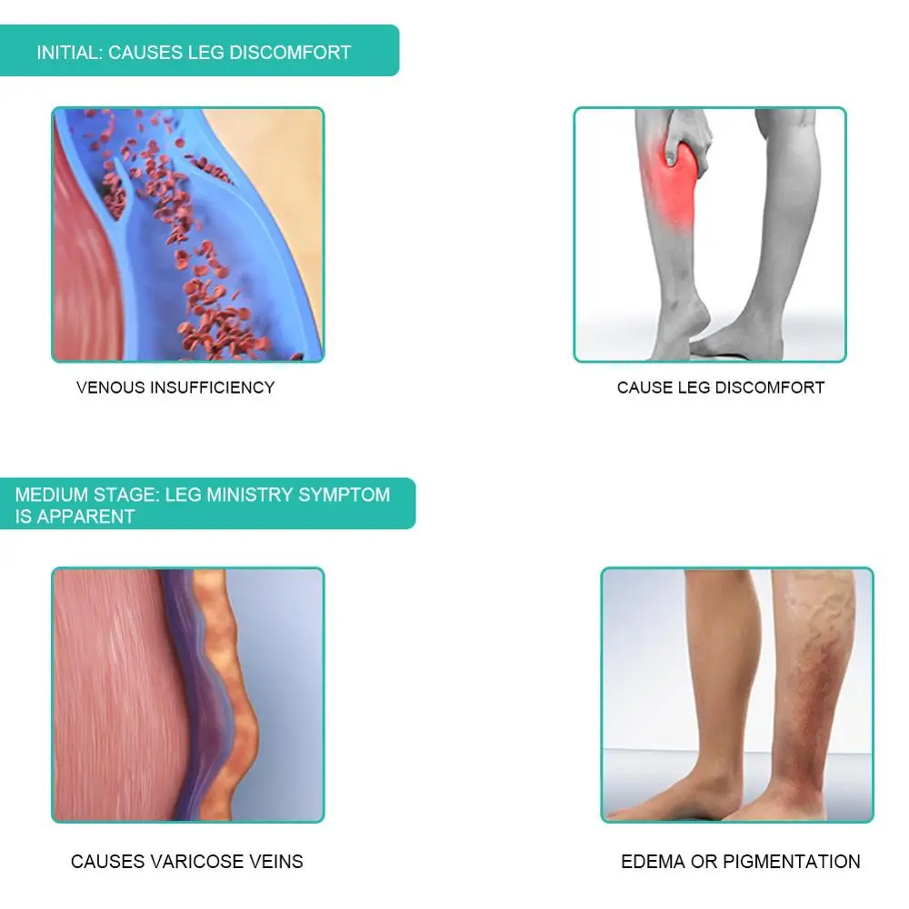 1Pair Medical Compression Sock - огляд і ціна Compression Sock Medical