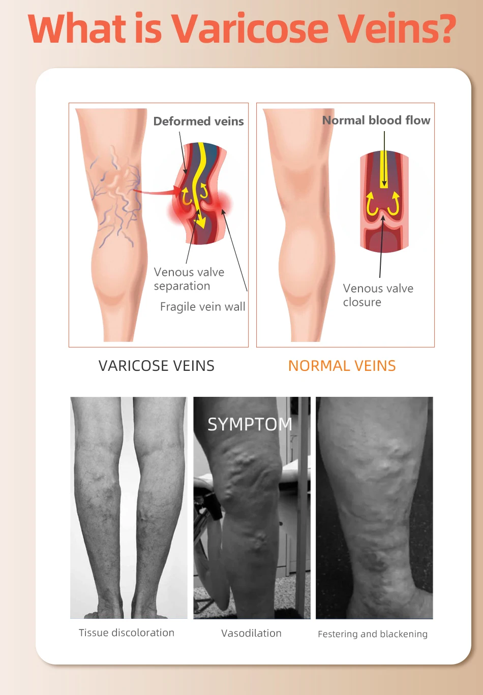 30-40 MmHg Over Knee Closed To - огляд і ціна Compression Sock Medical